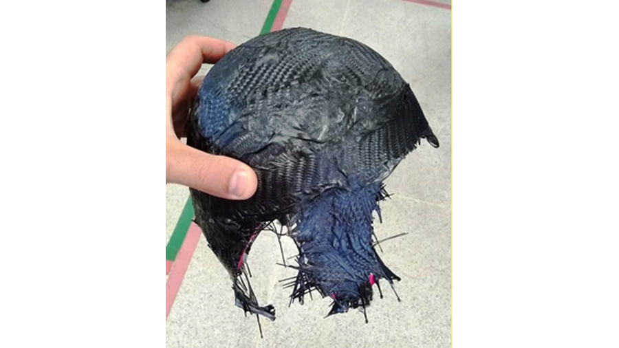 Com o intuito de aumentar a segurança de uma criança com paralisia cerebral e microcefalia com histórico frequente de quedas, foi desenvolvido uma capacete customizado em fibra de carbono e hastes de aço.