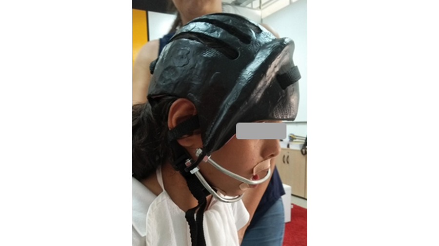 A imagem apresenta a foto de um capacete preto, confeccionado em fibra de carbono, em uso por uma criança.